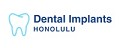 Dental Implants Honolulu